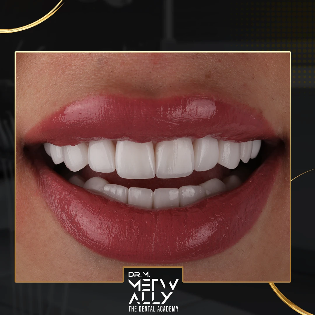 Over 10 years of creating beautiful smiles