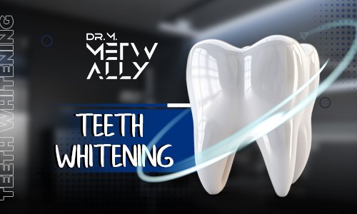 Dental Bleaching